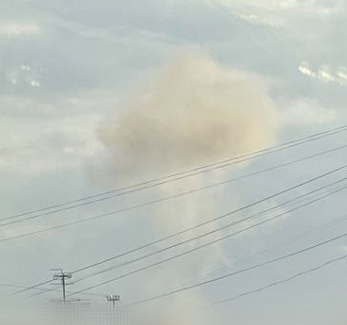 Вибух у Житомирі: 12-річна дитина в лікарні з осколковими пораненнями