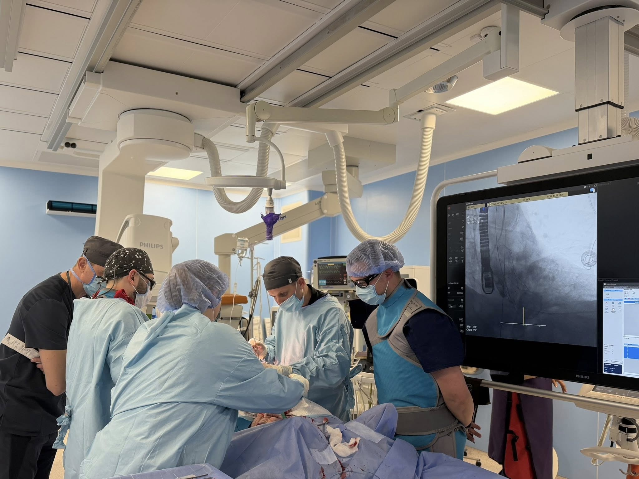 Вінницькі хірурги двічі виконали унікальну операцію на серці