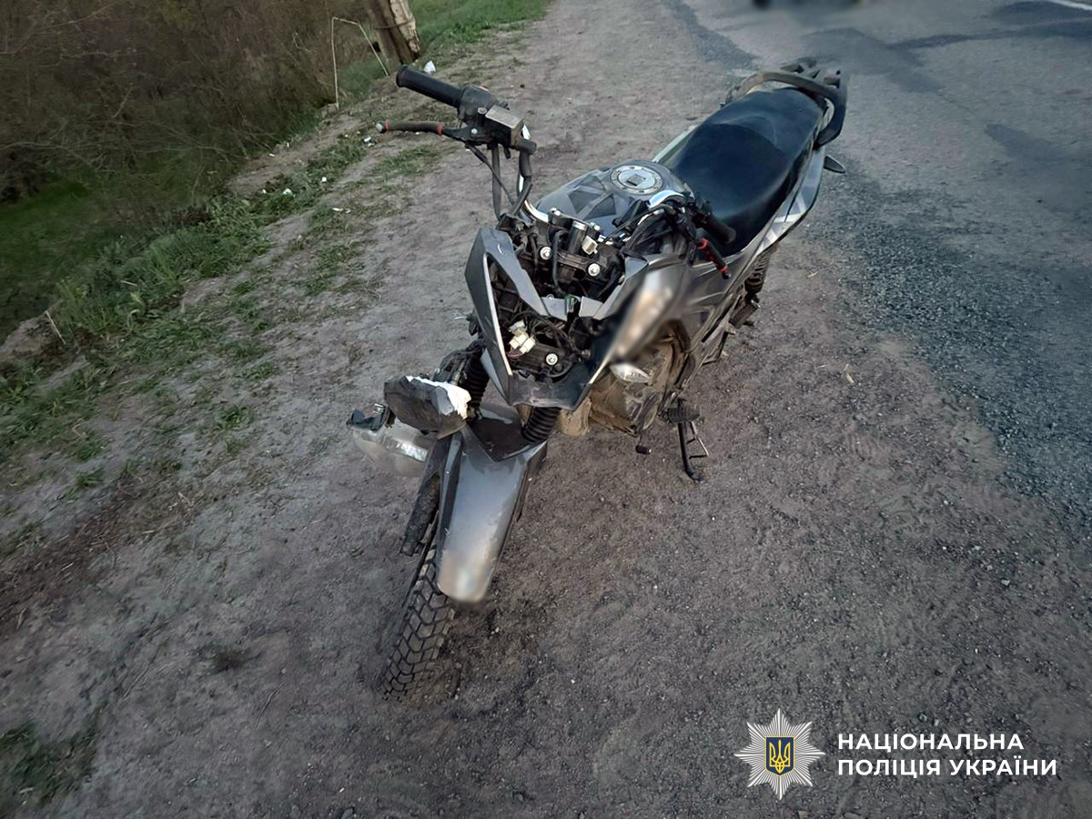 ДТП на Коростенщині: 25-річний мотоцикліст потрапив до нейрохірургії після падіння …