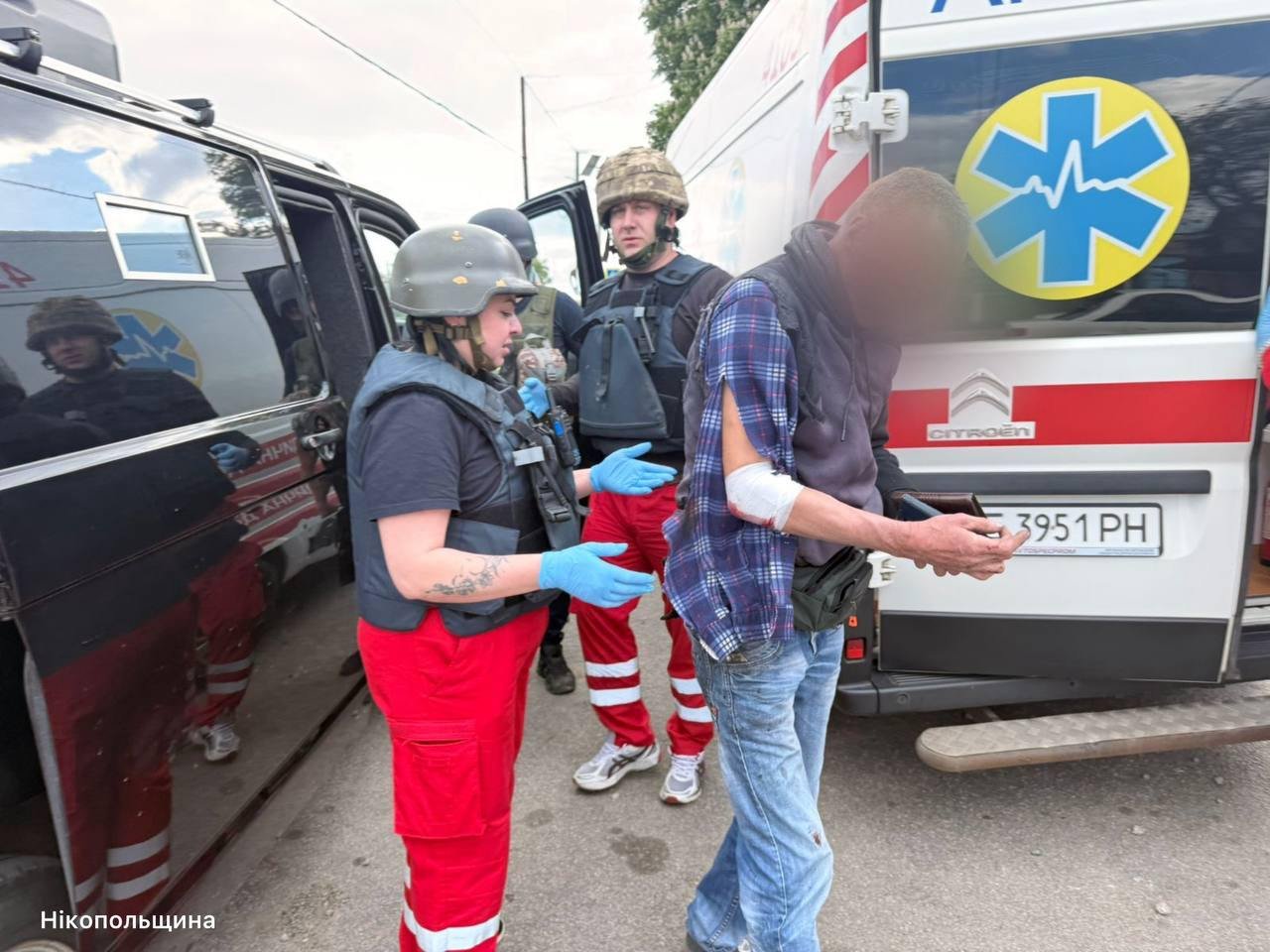 Двоє людей отримали поранення внаслідок обстрілів Дніпропетровщини