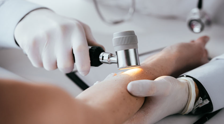 Де у Дніпрі якісно обстежують шкіру: особливості роботи спеціалізованого дерматологічного …