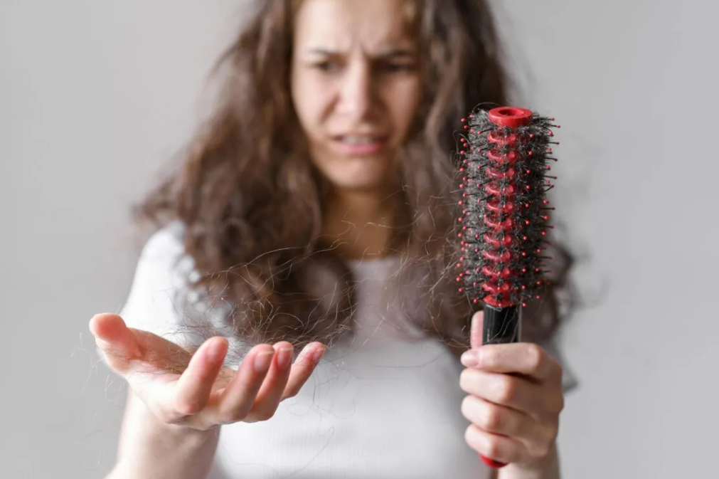Лікарі назвали причини випадіння волосся