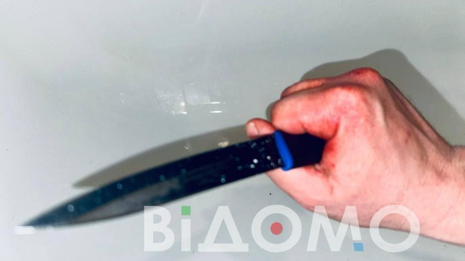 Напад з ножем у Дніпрі: постраждалий прикриває нападника