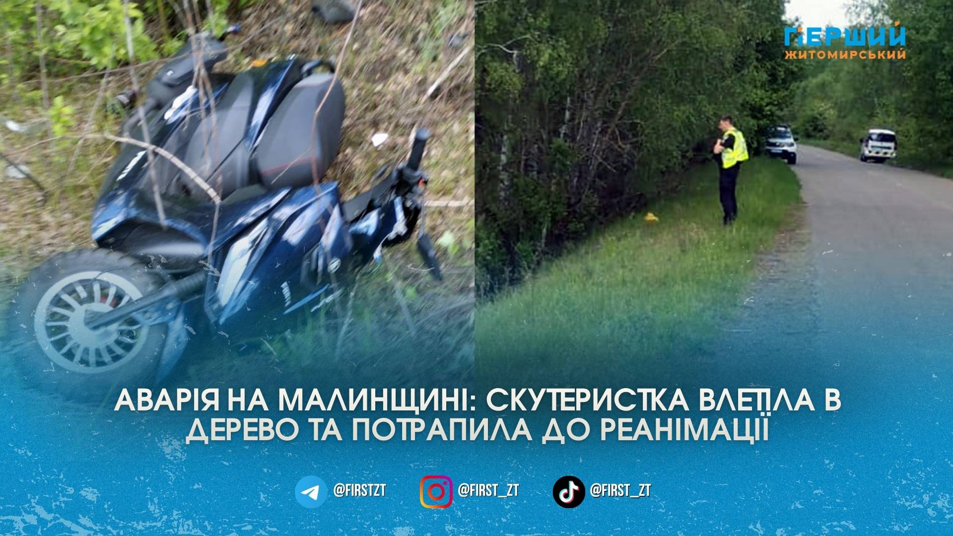 На Малинщині поїздка на скутері закінчилася для жінки реанімацією