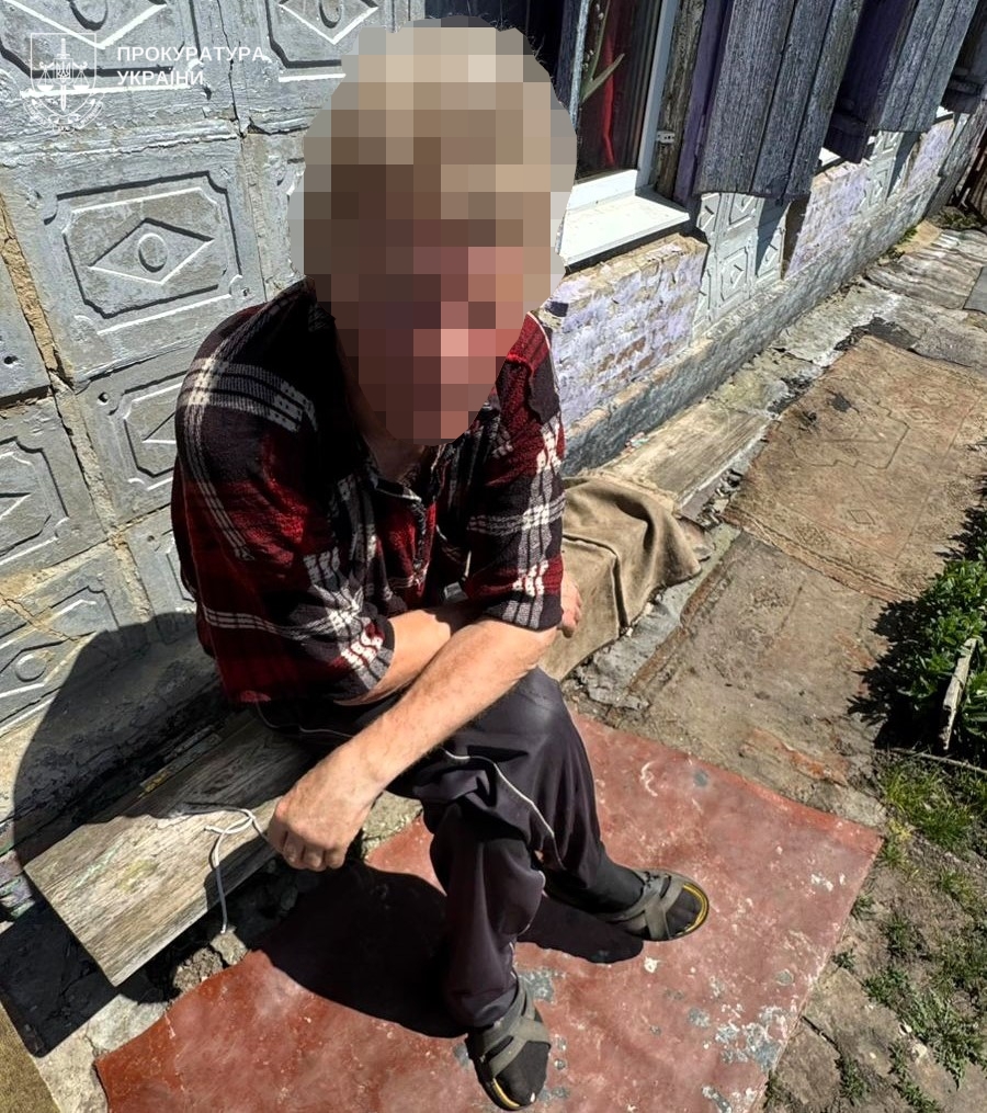 На Полтавщині обрано запобіжний захід нелюду, який підпалив співмешканку, - …