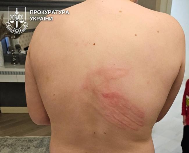 На Рівненщині батьку винесли вирок за знущання над 13-річним сином