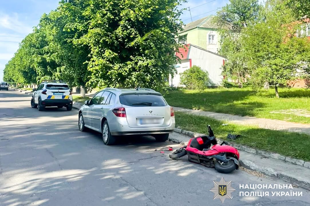 На Рівненщині знову травмувалася дитина на електротранспорті: 15-річний хлопець потрапив …