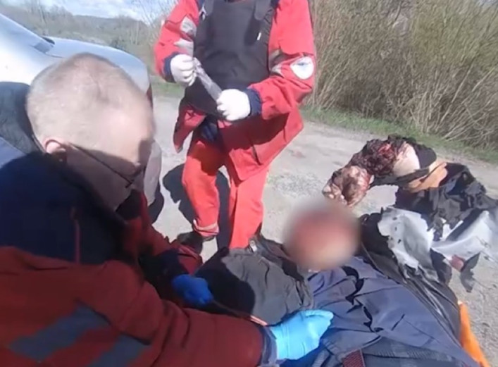 На Серединобудщині поліцейський врятував лісника після атаки дрона