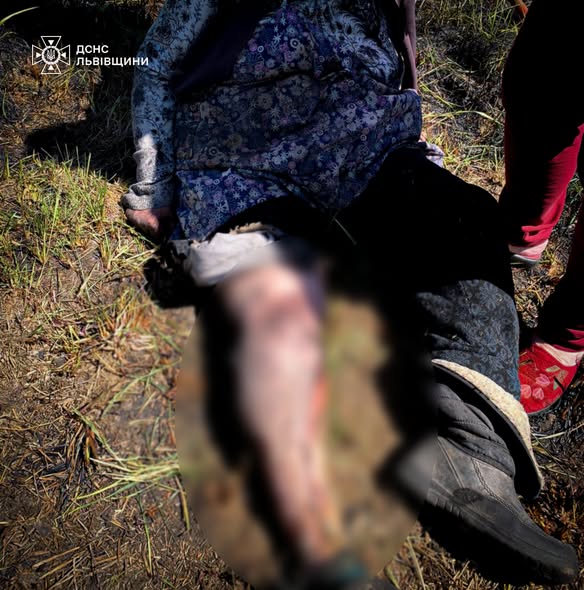 На Стрийщині під час пожежі сухої трави постраждала жінка