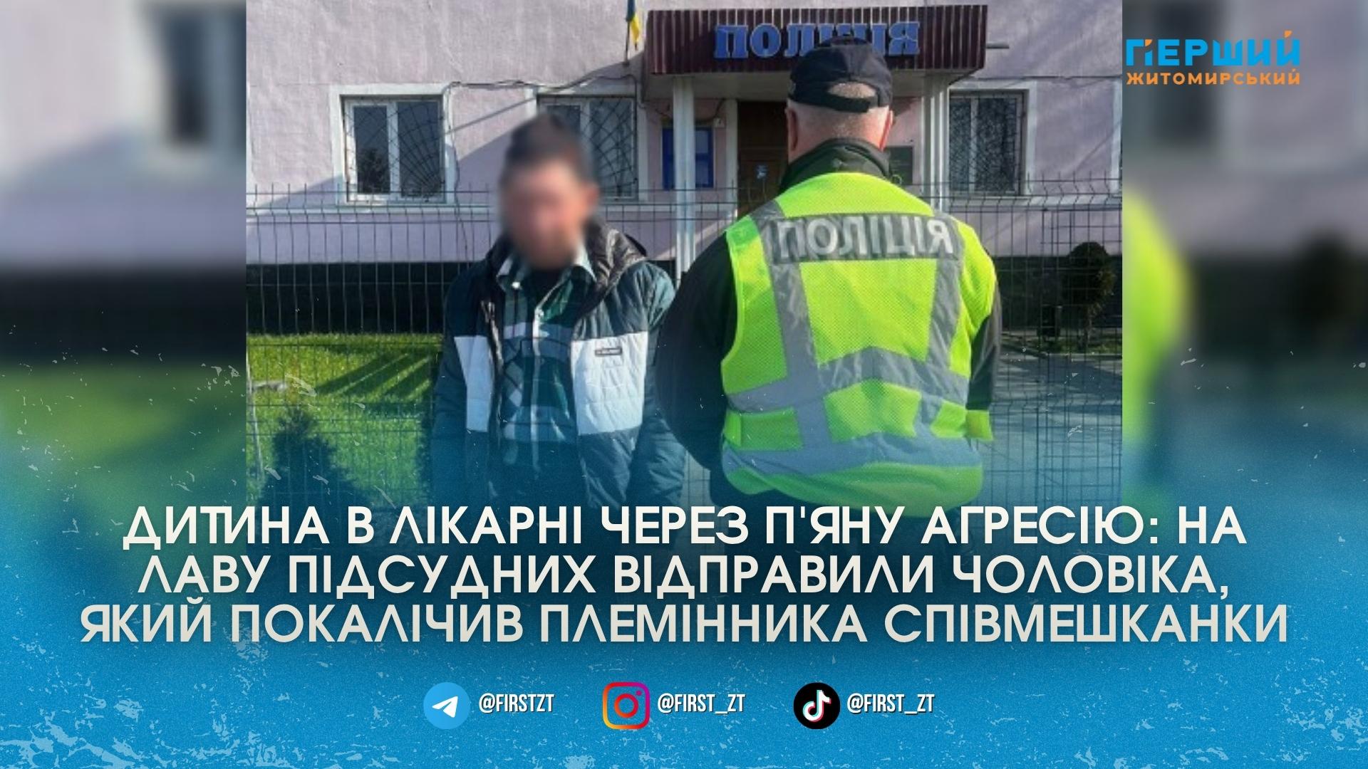 Нетверезий співмешканець тітки проломив штахетиною голову 10-річному хлопчику: на Житомирщині …