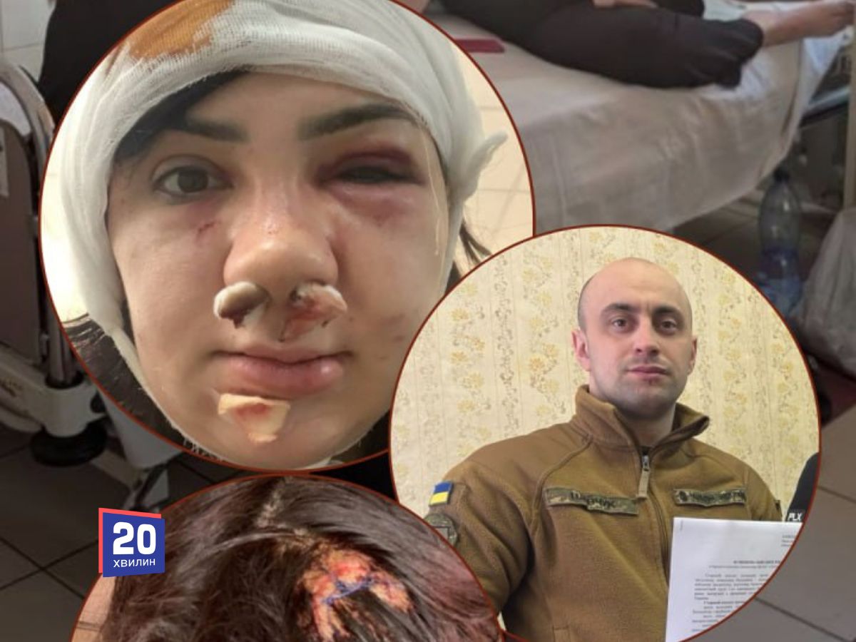 Побита до крові: у Вінниці військового підозрюють у нападі на …