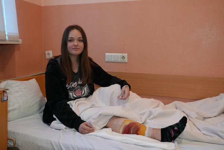Під час ракетного удару РФ по Івано-Франківську поранено журналістку