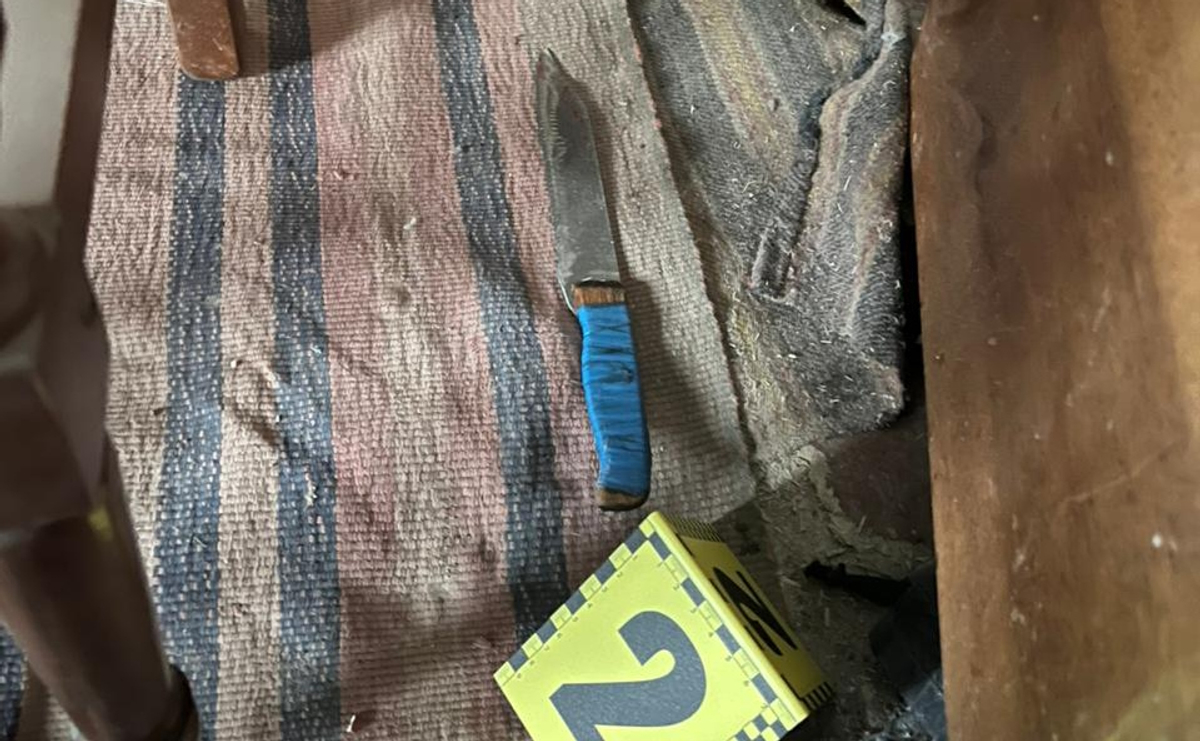 На Одещині чоловік через ревнощі вдарив брата-близнюка кухонним ножем