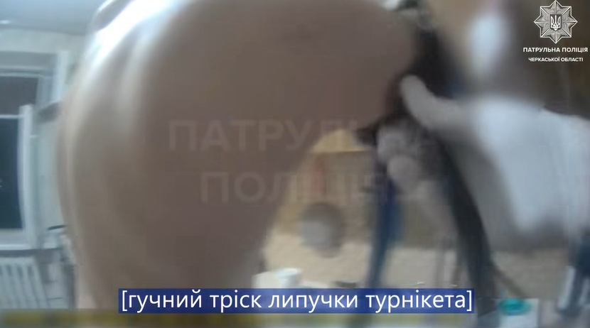 Травмувався під час зачинення дверей: у Черкасах допомогли чоловіку (ВІДЕО)