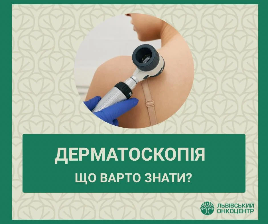 У Львівському онкоцентрі можна пройти дерматоскопію