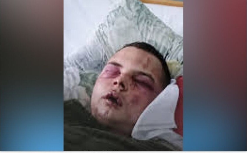 У Шахтарському військові «Вовків Да Вінчі» жорстоко побили та викрали …