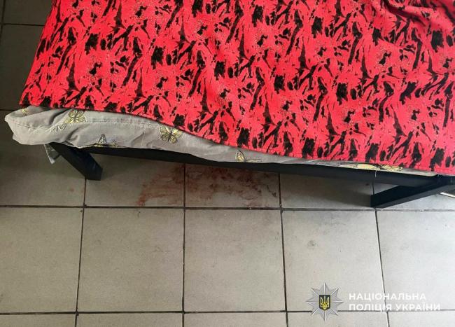 У медзакладі на Рівненщині чоловік побив сусіда по палаті