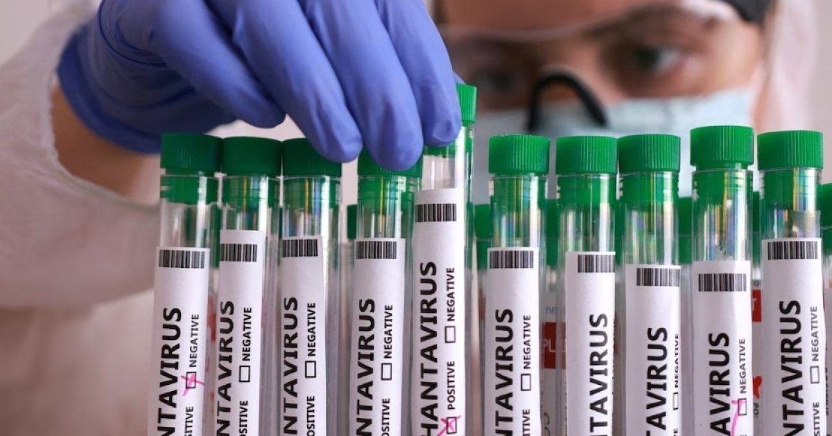Хантавірус Andes не становить високого ризику для України — Центр …