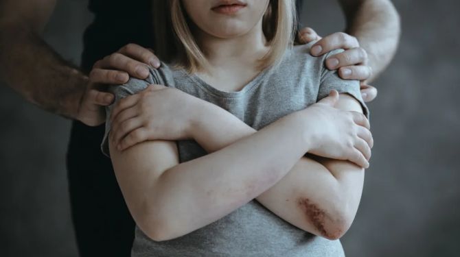 Чернівецький апеляційний суд призначив довічне за зґвалтування 13-річної дитини